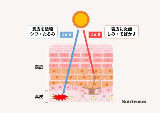 紫外線がシミやそばかすの原因